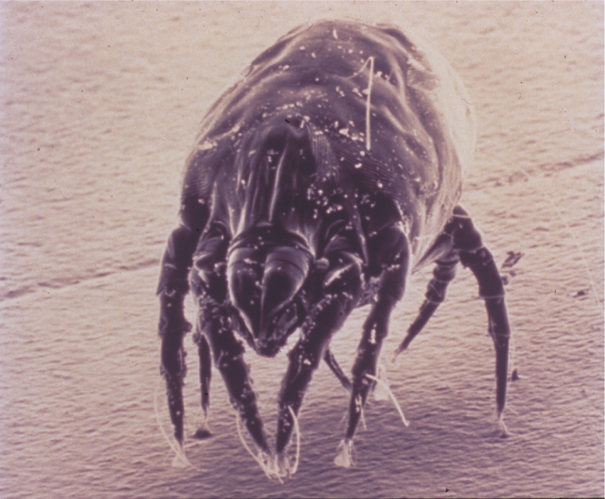 Dust Mite Photos AAAAI